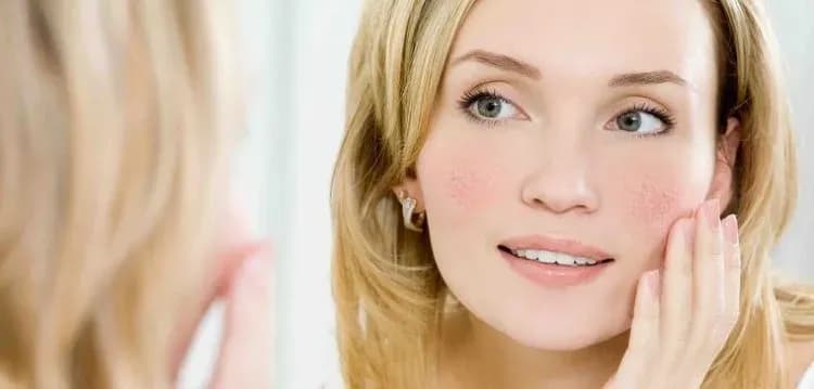 Jaki kolor włosów do cery naczynkowej, aby zminimalizować zaczerwienienia?