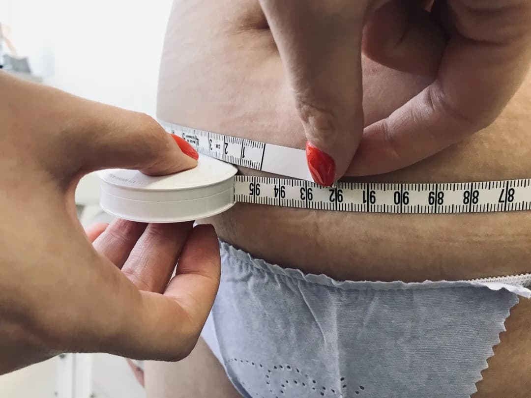 Liposukcja ultradźwiękowa: jak wygląda zabieg i czego się spodziewać