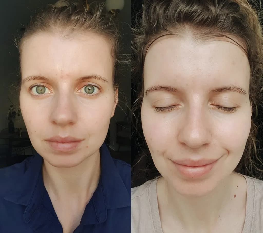 Jak mieć ładną cerę bez makijażu – skuteczne sposoby na naturalne piękno